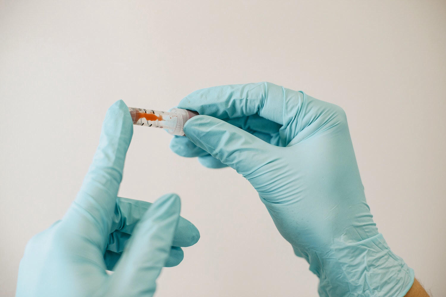 【健管師專欄】為什麼會有長新冠?有什麼症狀?會持續多久?除了腦霧、咳嗽你需要知道的長新冠補帖 - 第3張圖
