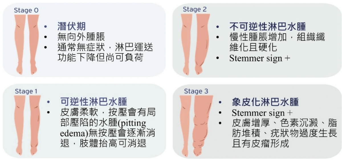 【物理治療師專欄】淋巴是什麼?腿腫起來就是淋巴問題?淋巴水腫常見5個迷思 - 第7張圖